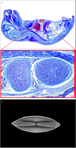 kinh-hien-vi-soi-noi-discovery-v20